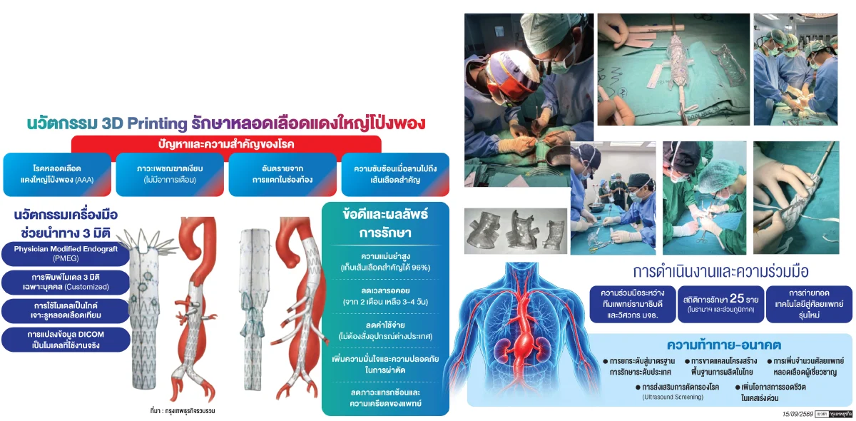 นวัตกรรมกู้ชีวิต ‘AI-3D Printing’ เปลี่ยนการรอ ให้กลายเป็นโอกาสรอด